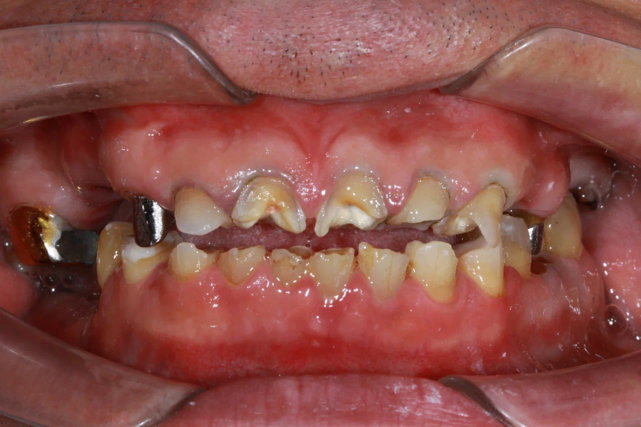Before image