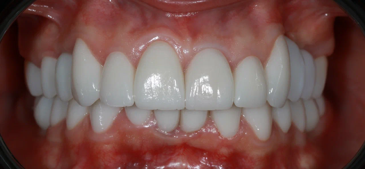 After image