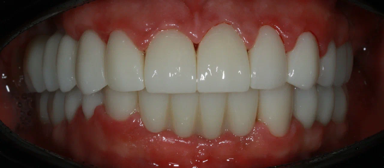 After image