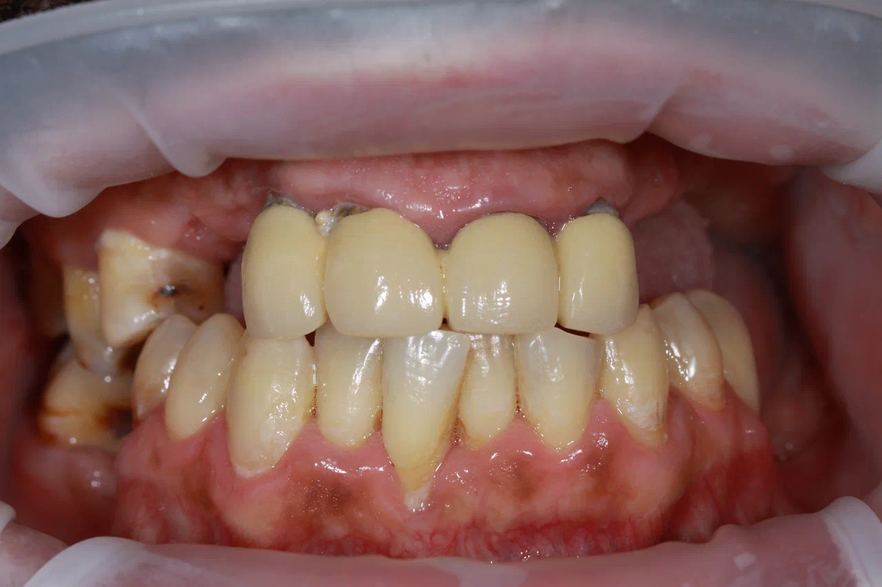 Before image