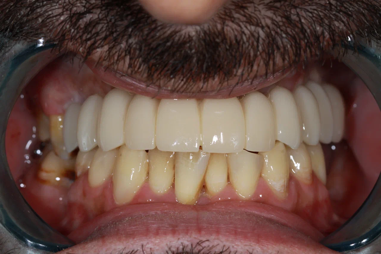 After image